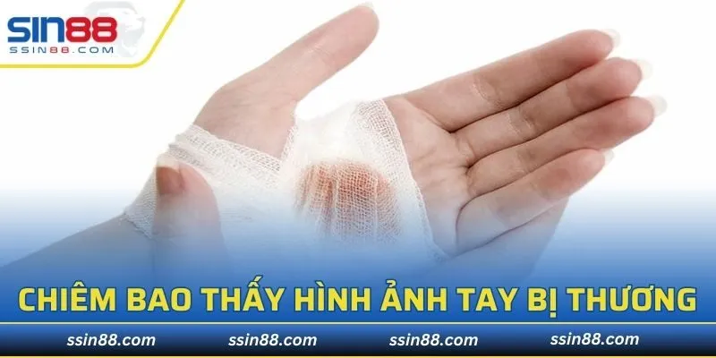 Chiêm bao thấy hình ảnh tay mình đang bị thương và ý nghĩa